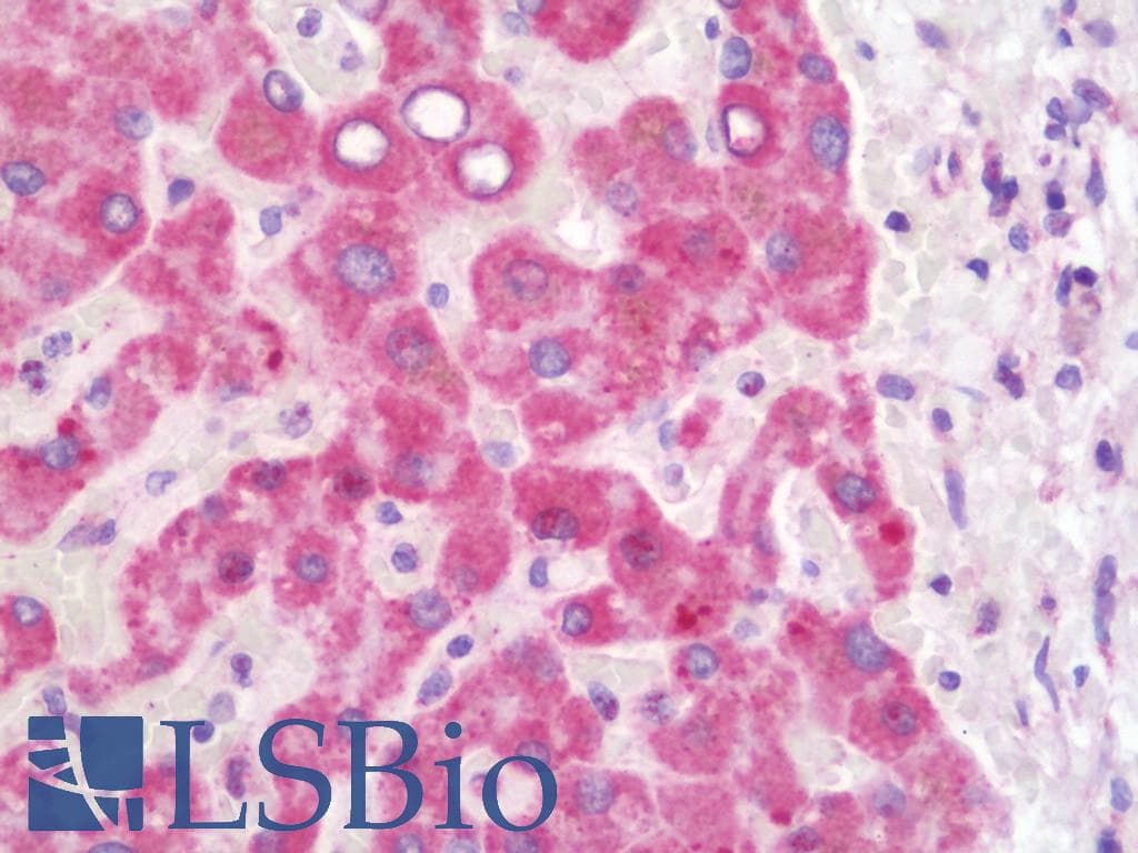 IHC-plus™ HADHB Antibody
