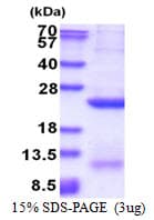 Human GPC4 / Glypican 4 Protein (Recombinant His)