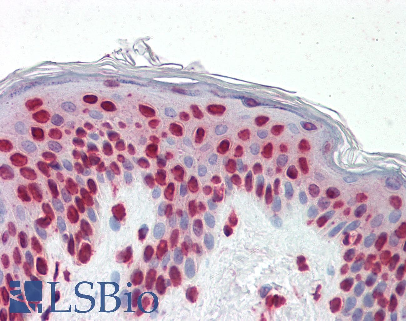 IHC-plus™ Monoclonal Mouse anti-Human GSC / Goosecoid Antibody (clone 2C1, IHC, WB)
