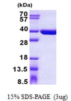 Human SULT1C4 / Sulfotransferase 1C4 Protein (Recombinant His)