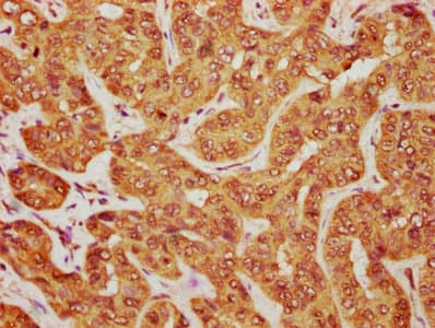 Polyclonal Rabbit anti-Human MOB1B / MOBKL1A Antibody (aa2-216, WB)
