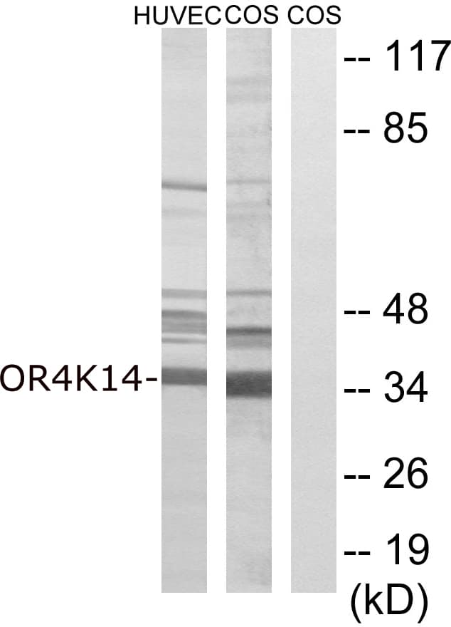 Polyclonal Rabbit anti-Human OR4K14 Antibody (aa261-310, WB)