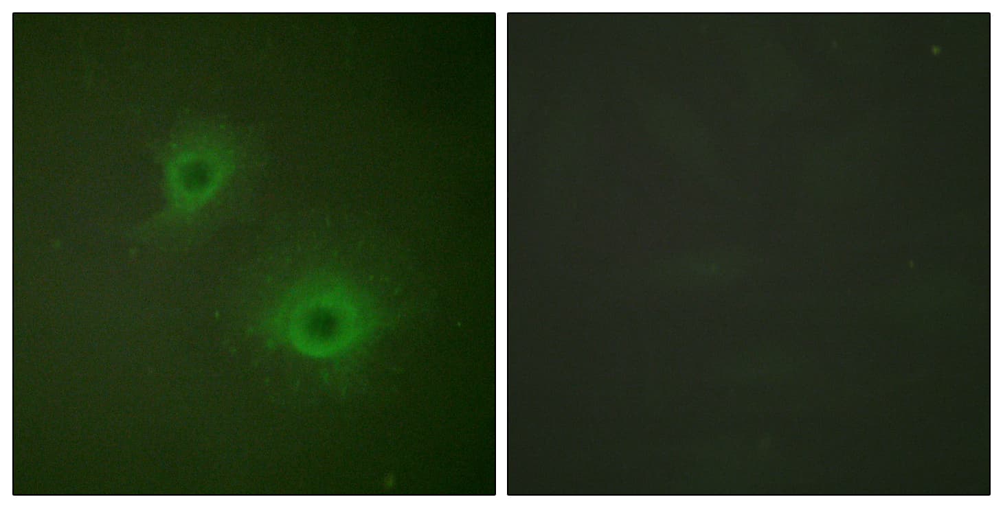 EPH Receptor B1+B2 Antibody (Internal)