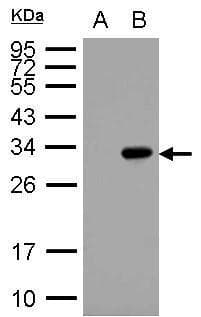 Monoclonal Mouse anti-Schistosoma japonicum GST / Glutathione S-Transferase Antibody (clone 1B3, aa1-425, WB)