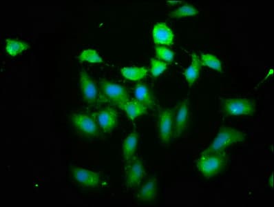Polyclonal Rabbit anti-Human PIH1D1 Antibody (IHC, WB)