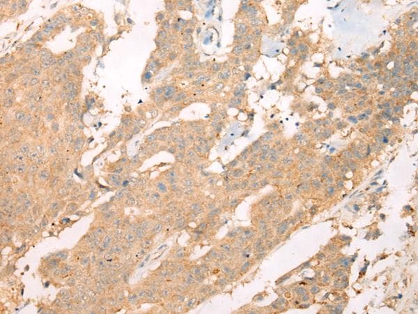 Polyclonal Rabbit anti-Human ACCN3 / ASIC3 Antibody (IHC)