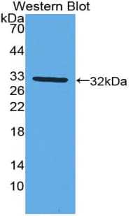 CYP27B1 Antibody (aa256-508)