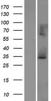 SCEH / ECHS1 Protein (Over-Expression Lysate Myc-DDK (Flag))