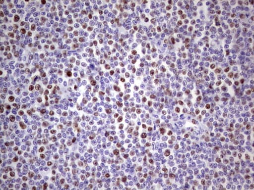 Monoclonal Mouse anti-Human MCM2 Antibody (clone OTI3C12, IHC, WB)