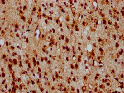 Polyclonal Rabbit anti-Human HIPK2 Antibody (IHC)