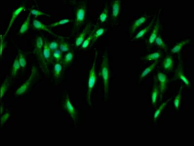 CASP2 / Caspase 2 Antibody (aa2-452)