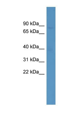 ZNF189 Antibody (N-Terminus)