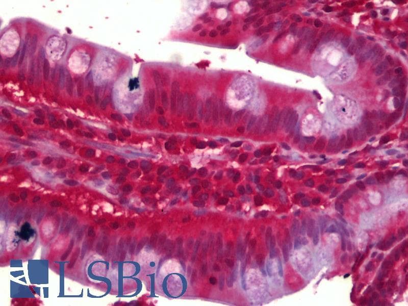 IHC-plus™ CNR2 / CB2 Antibody