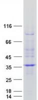Human RWDD2A Protein (Recombinant Myc-DDK (Flag))