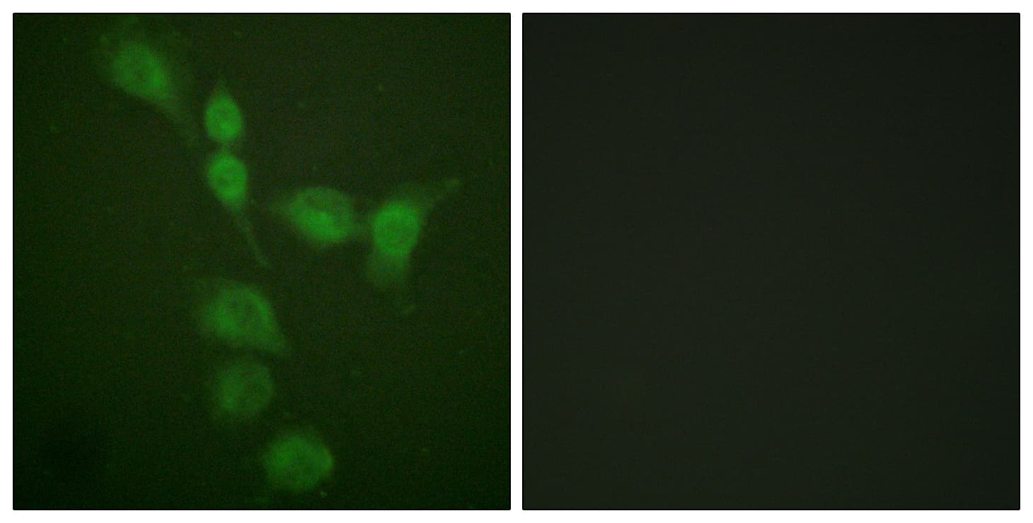 Protein Kinase A (PKA) Catalytic Subunit Antibody