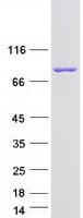 Human CAPN12 / Calpain 12 Protein (Recombinant Myc-DDK (Flag))