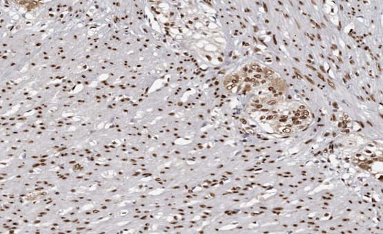 MAPKAPK3 Antibody