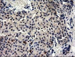 GGPS1 Antibody (clone OTI3F9)