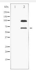 SIRT1 / Sirtuin 1 Antibody