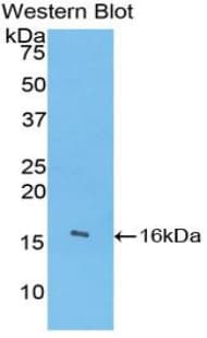 Angiogenin / ANG Antibody (aa24-148)