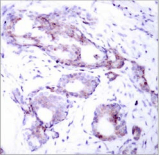 MYC / c-Myc Antibody