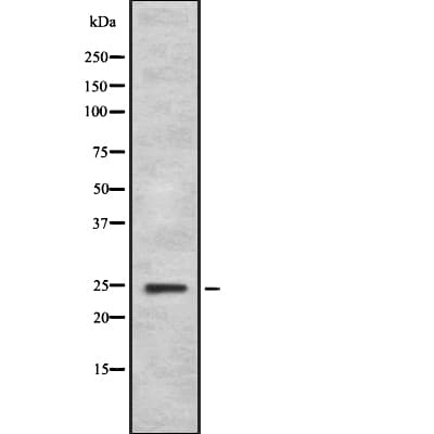 FGF11 / FGF-11 Antibody