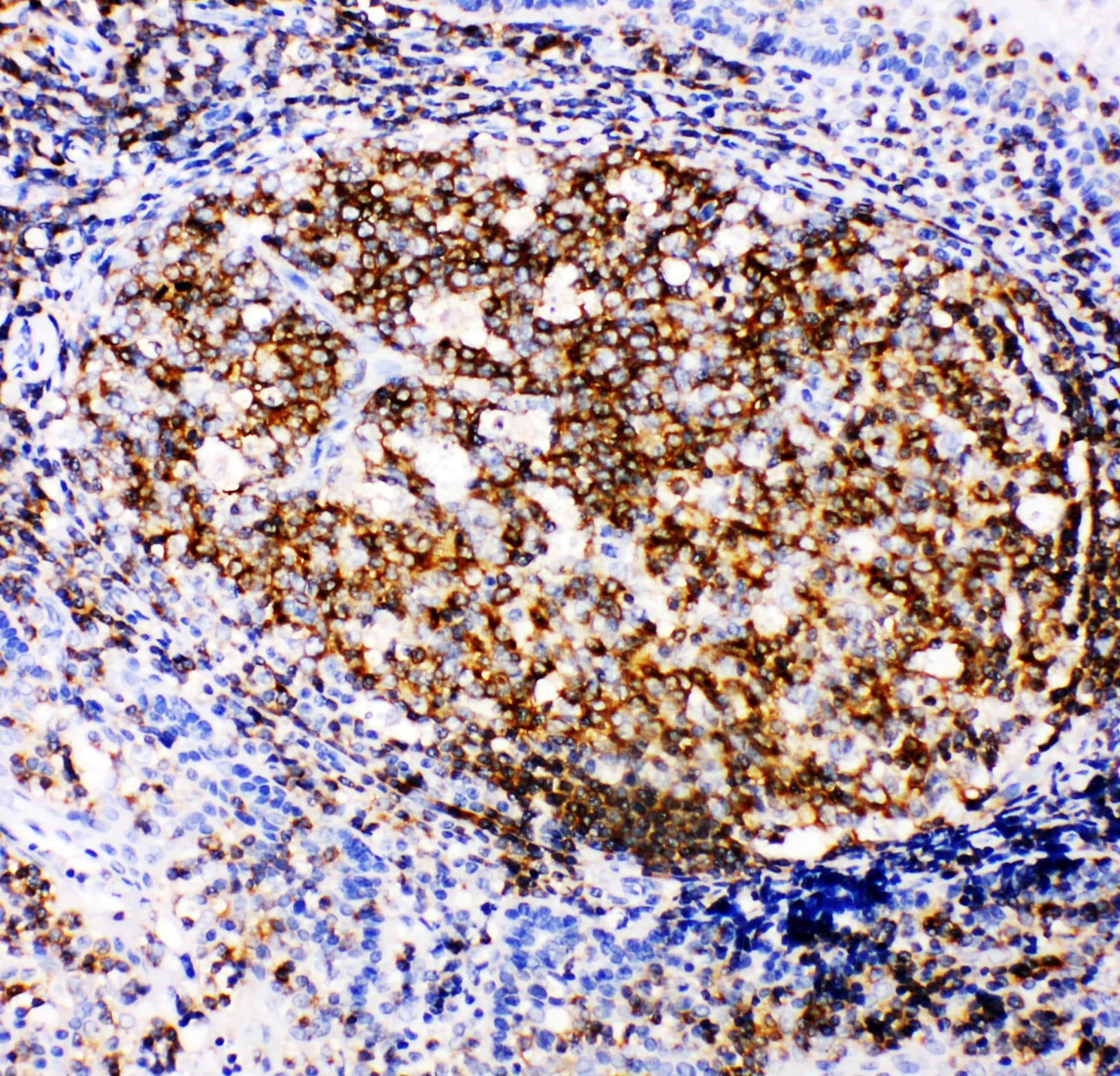 APBB1IP / RIAM Antibody (aa647-666)