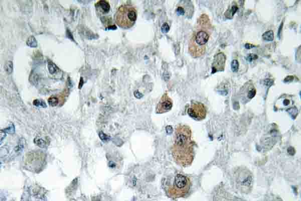 Polyclonal Rabbit anti-Human GNPAT / DHAP-AT Antibody (Phe365, IHC, WB)