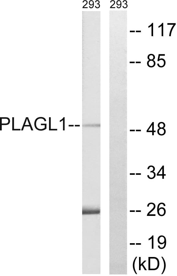 IHC-plus™ Polyclonal Rabbit anti-Human PLAGL1 / ZAC Antibody (aa311-360, IHC, WB)