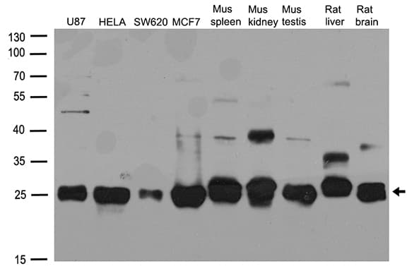 CSNK2B / Phosvitin Antibody