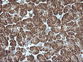 MAP2K1 / MKK1 / MEK1 Antibody (clone OTI4E4)