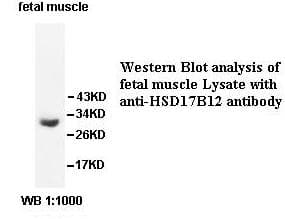 HSD17B12 Antibody (aa27-181)