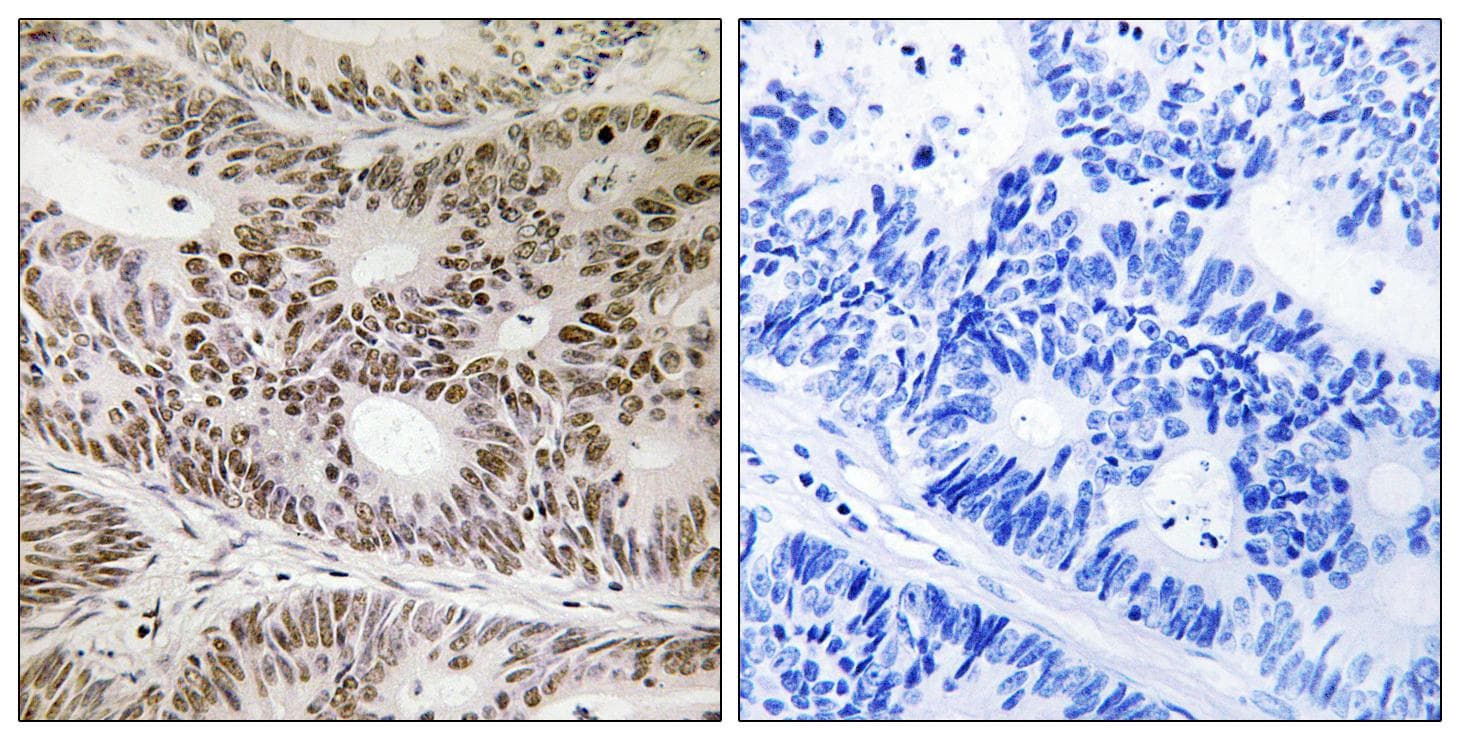 Polyclonal Rabbit anti-Human STAT2 Antibody (phospho-Tyr631, IHC)