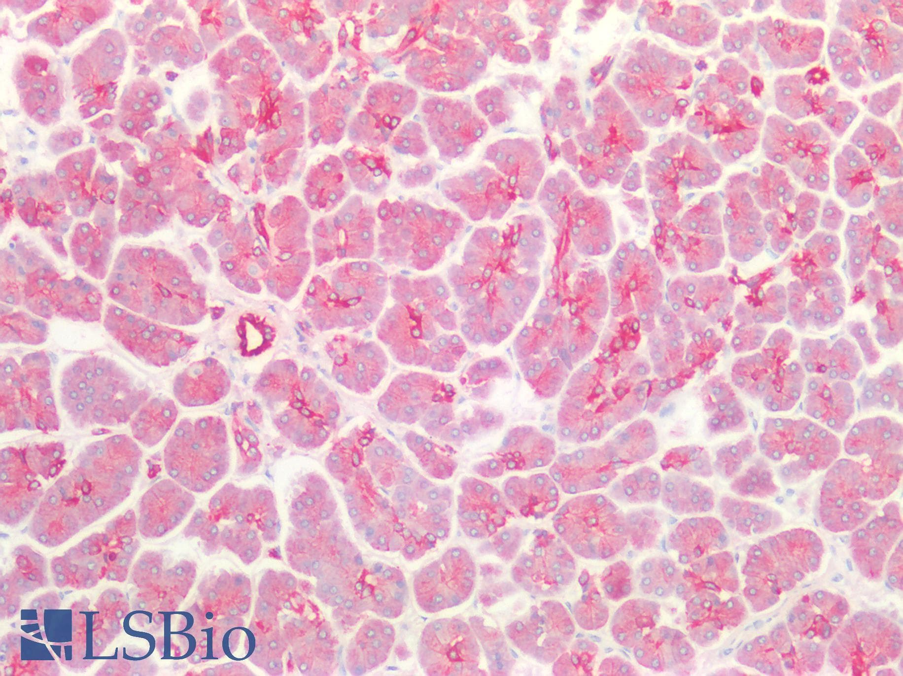 IHC-plus™ Monoclonal Mouse anti-Human KRT18 / CK18 / Cytokeratin 18 Antibody (IHC, WB)