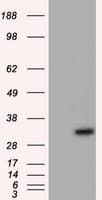 NIT2 Antibody (clone OTI1A6)