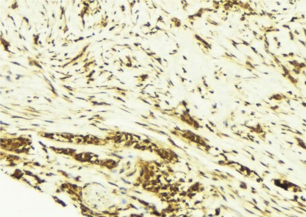 Polyclonal Rabbit anti-Human AP-1 / JUND Antibody (IHC, IF, WB)