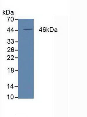 PPARD / PPAR Delta Antibody (aa260-426)