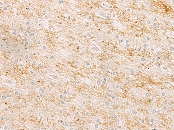 Polyclonal Rabbit anti-Human RHCG Antibody (IHC, WB)