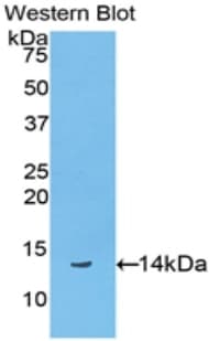 BGN / Biglycan Antibody (aa48-158)