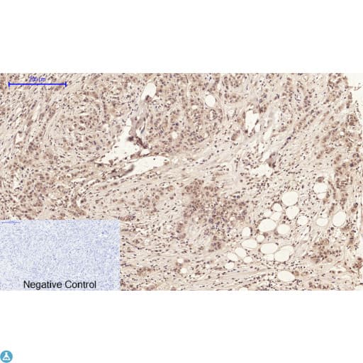 Polyclonal Rabbit anti-Human ANXA1 / Annexin A1 Antibody (IHC, WB)