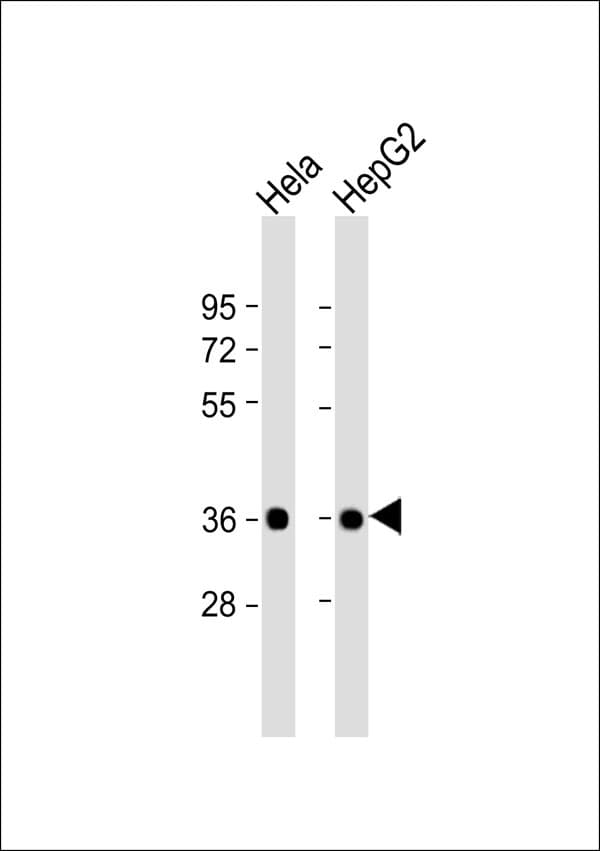 BABP / AKR1C2 Antibody