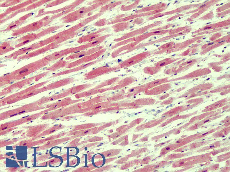 IHC-plus™ IRAK4 / IRAK-4 Antibody (aa2-13)