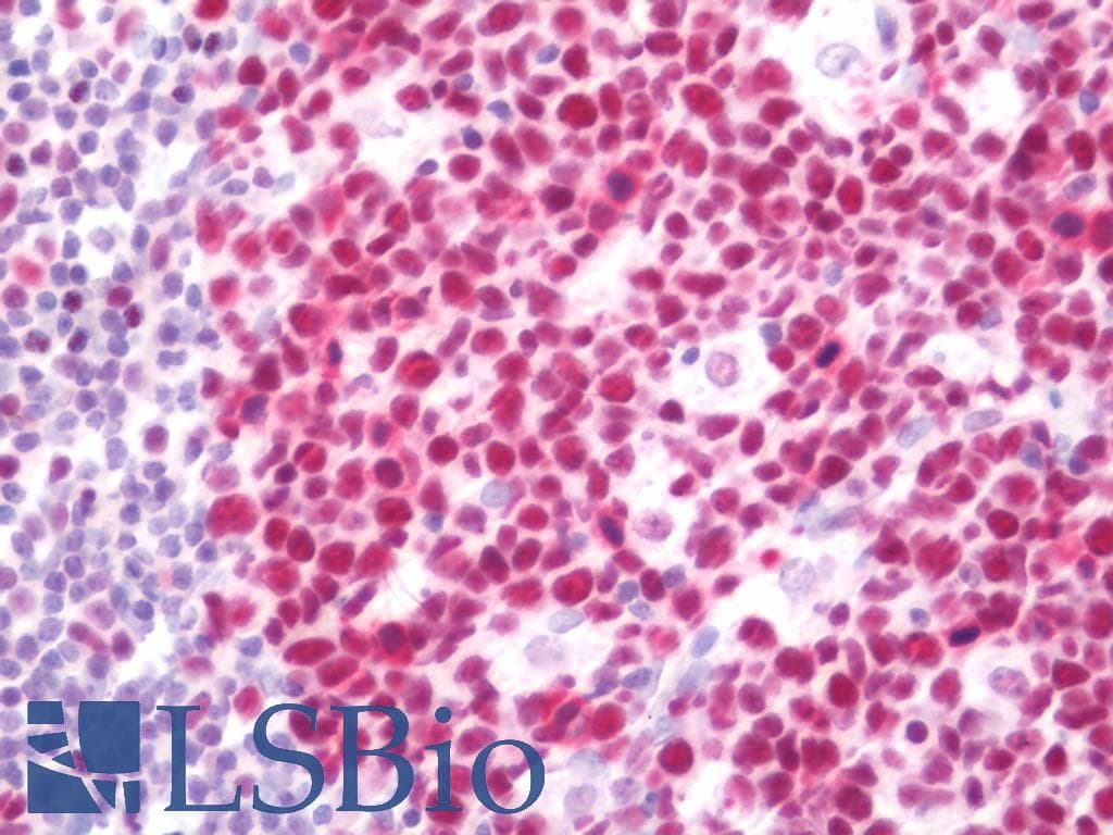 IHC-plus™ FEN1 Antibody (aa250-300)