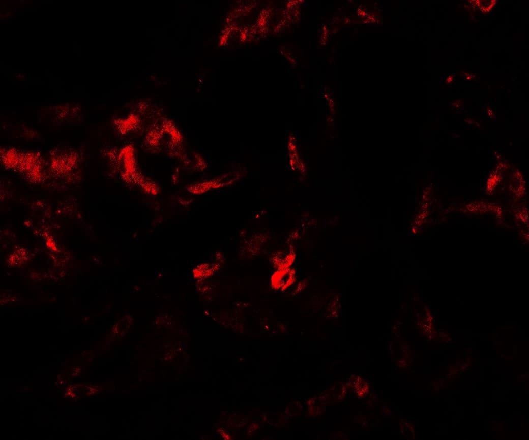 IHC-plus™ Polyclonal Rabbit anti-Human PSPLA1 / Phospholipase A1 Antibody (IHC, IF, WB)