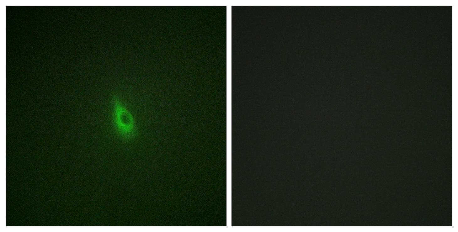 ITPR1 / IP3 Receptor Type 1 Antibody (phospho-Ser1598/1588)