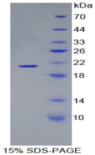 Horse HBA1 Protein (Recombinant His-S)