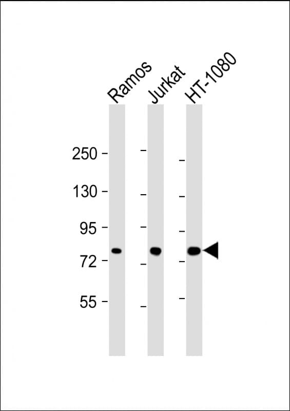 GARS / Glycyl tRNA Synthetase Antibody (clone 1641CT125.1.1)