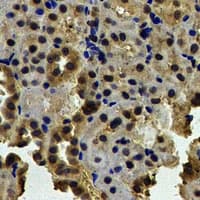 NAP1L1 Antibody