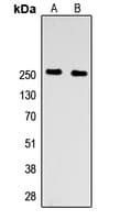 F5 / Factor Va Antibody (N-Terminus)