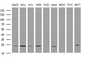 RIT2 / RIN Antibody (clone OTI4A6)